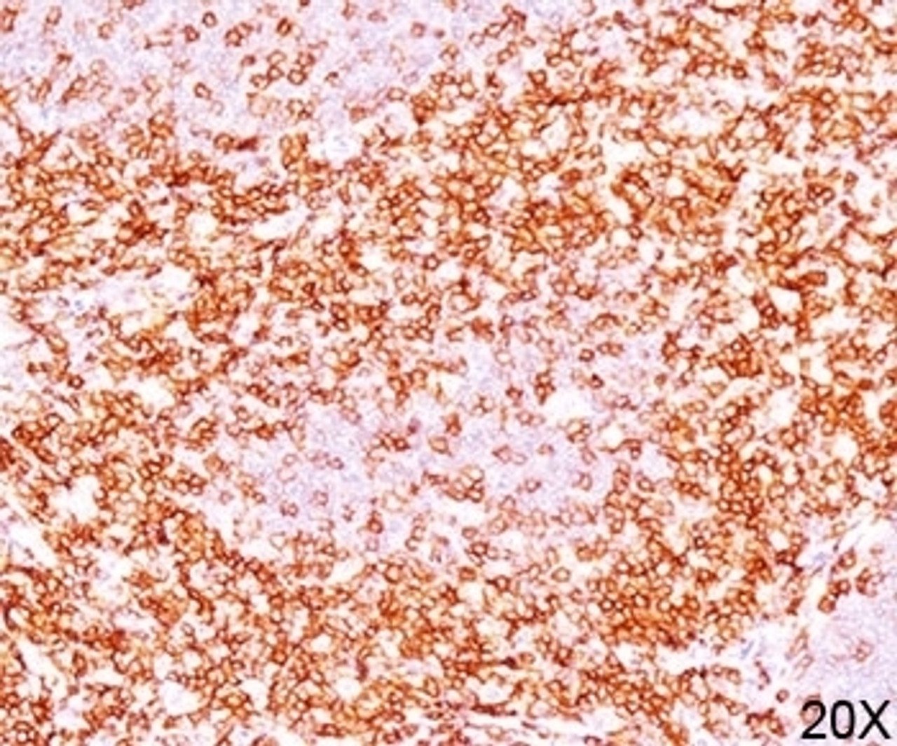 IHC testing of human tonsil (10X) stained with CD6 antibody (C6/372) .