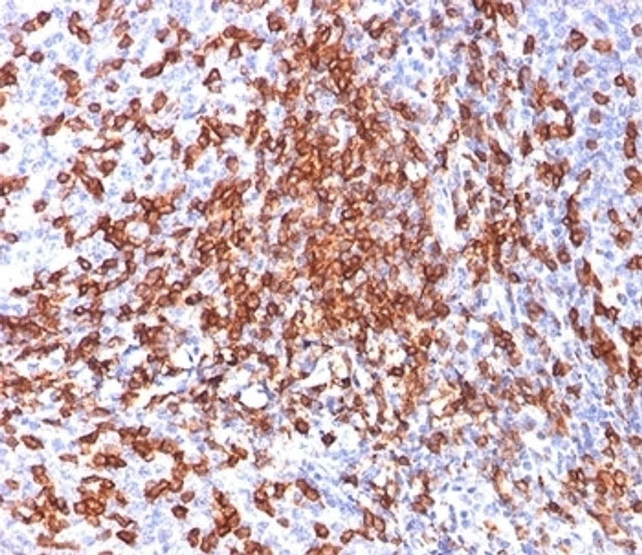 IHC testing of human tonsil stained with HCAM antibody (156-3C11) .