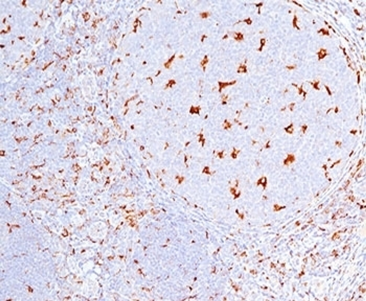 IHC testing of human tonsil (10X) stained with CD68 antibody (C68/684) .