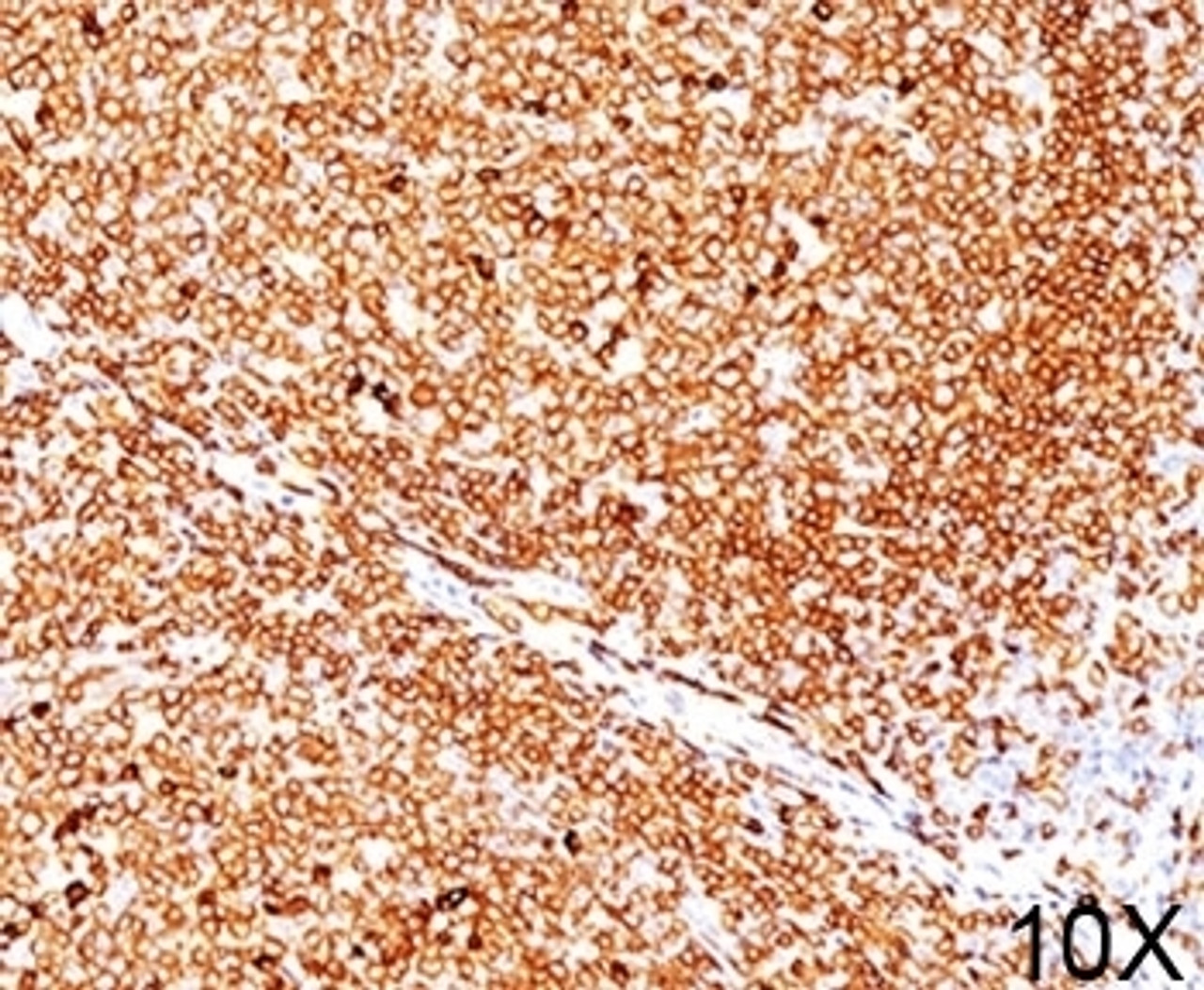 IHC testing of human tonsil (10X) stained with CD79a antibody (JCB117) .