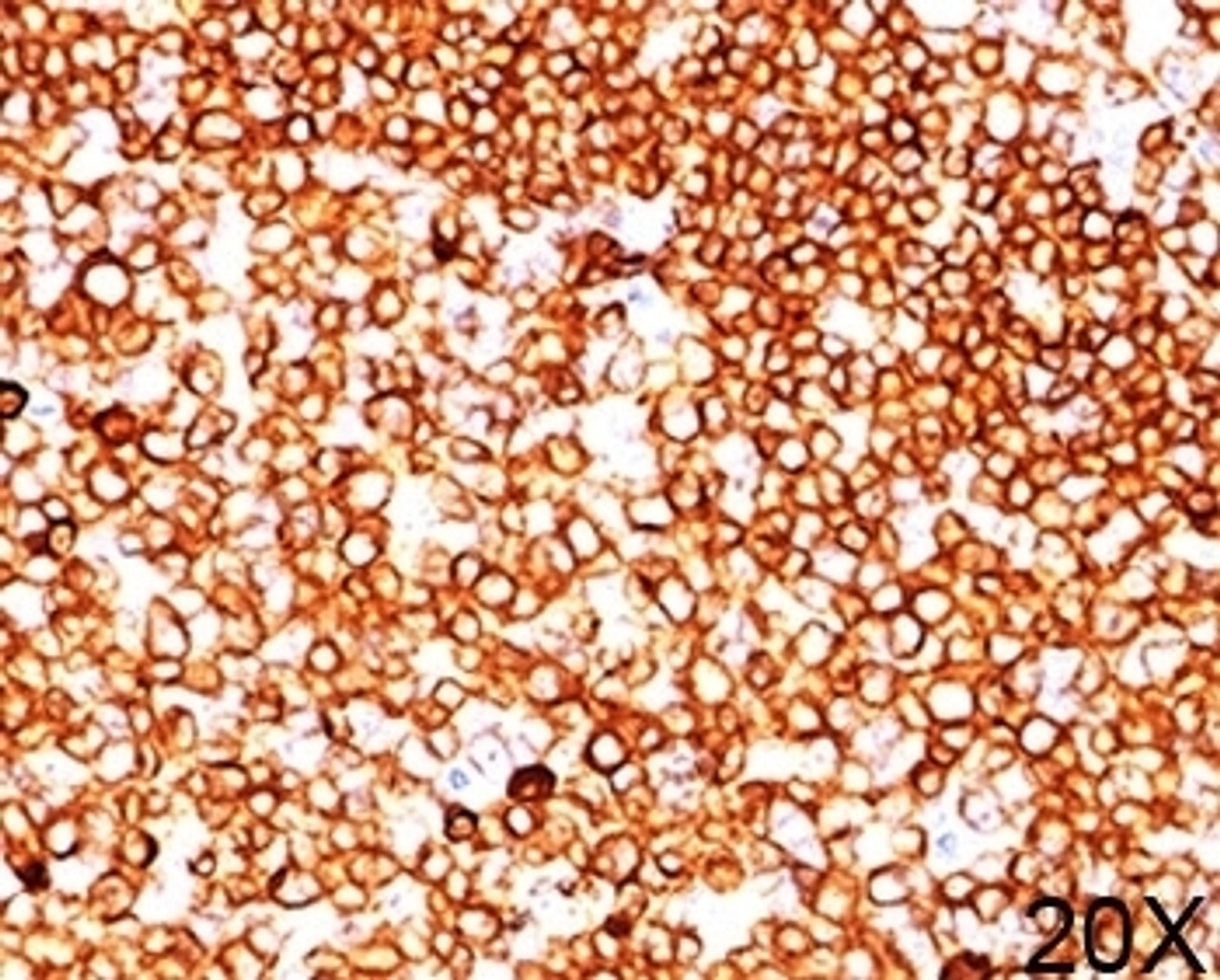 IHC testing of human tonsil (20X) stained with CD79a antibody (JCB117) .