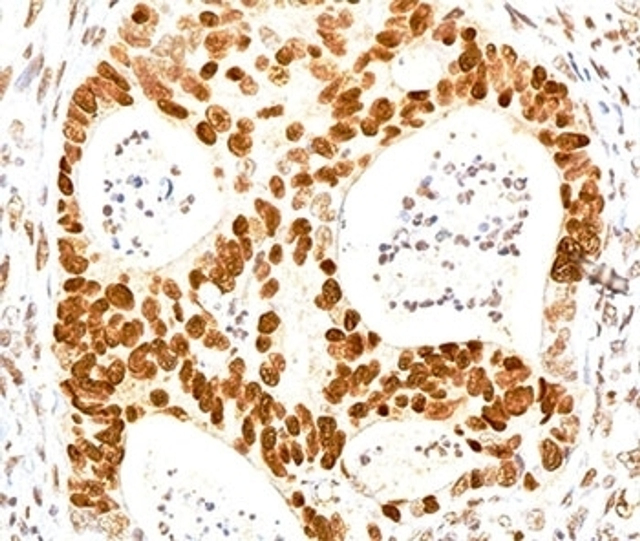 IHC testing of human colon stained with p27Kip1 antibody.