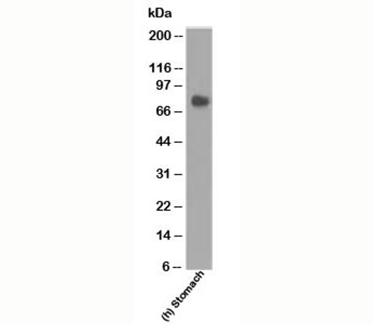 Western blot analysis of human samples using CEA Ab (COL-1) .