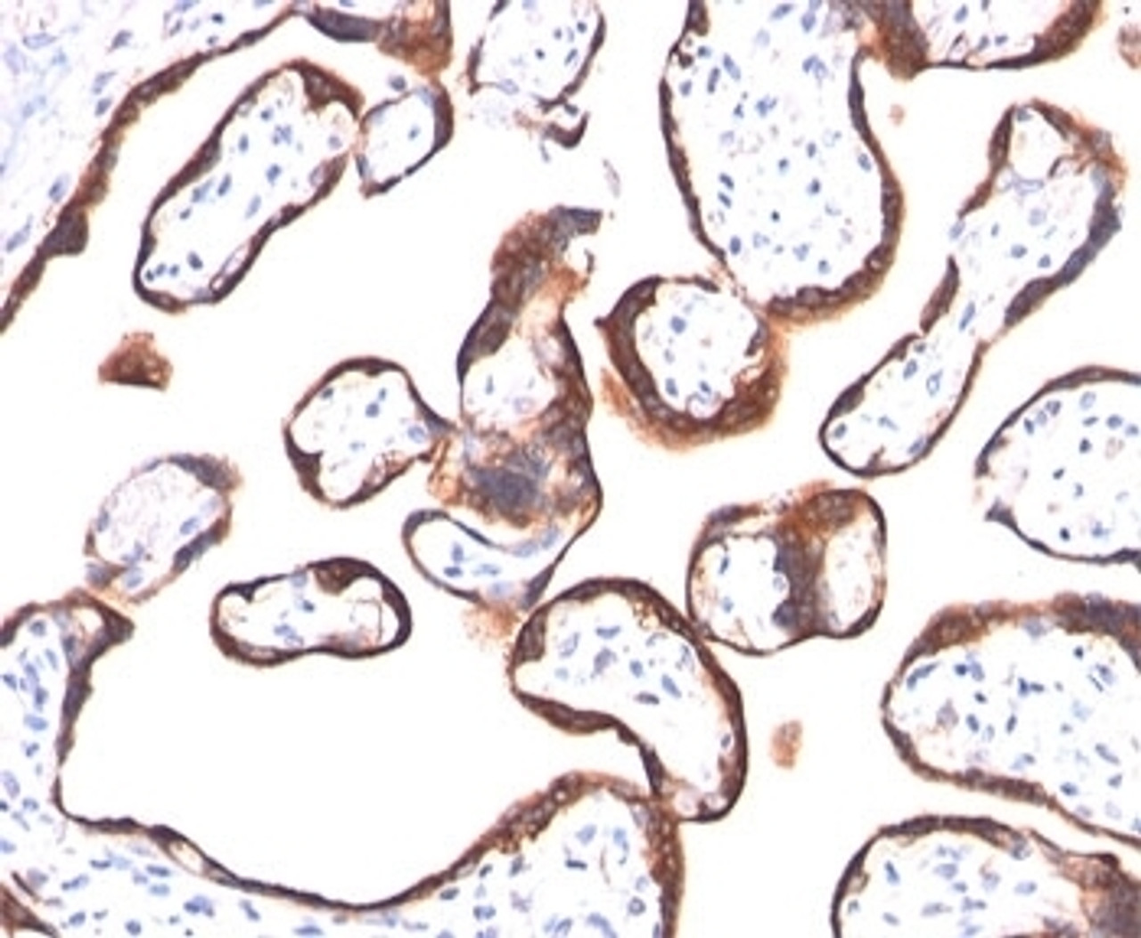 IHC testing of human placenta stained with HCG-alpha antibody (HCGa/53) . Note specific membrane staining.