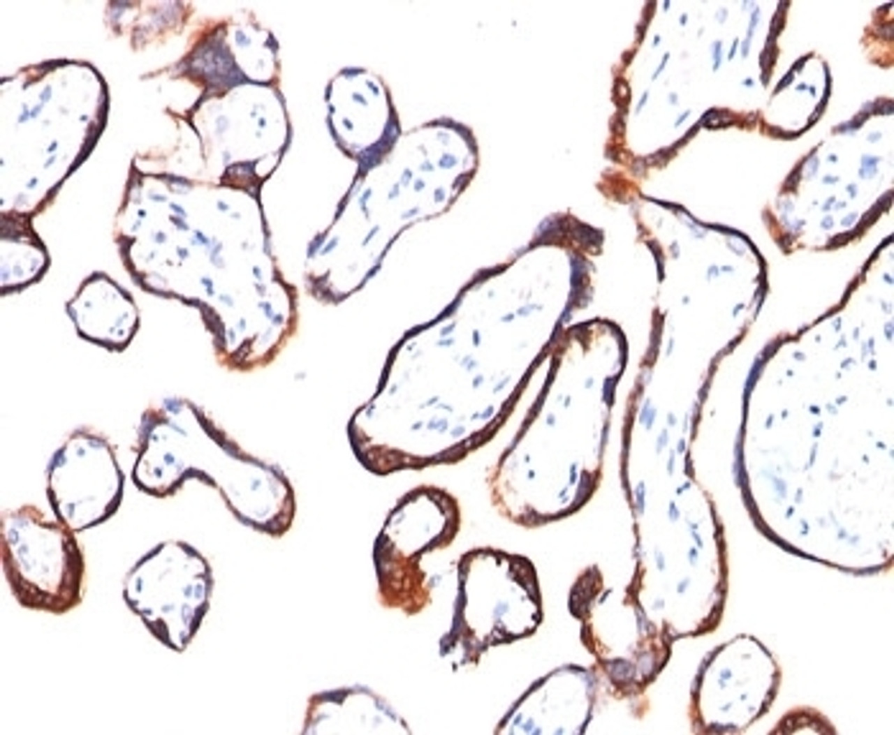 IHC testing of placenta stained with HCG-beta antibody (HCGb/54) . Note specific membrane staining.
