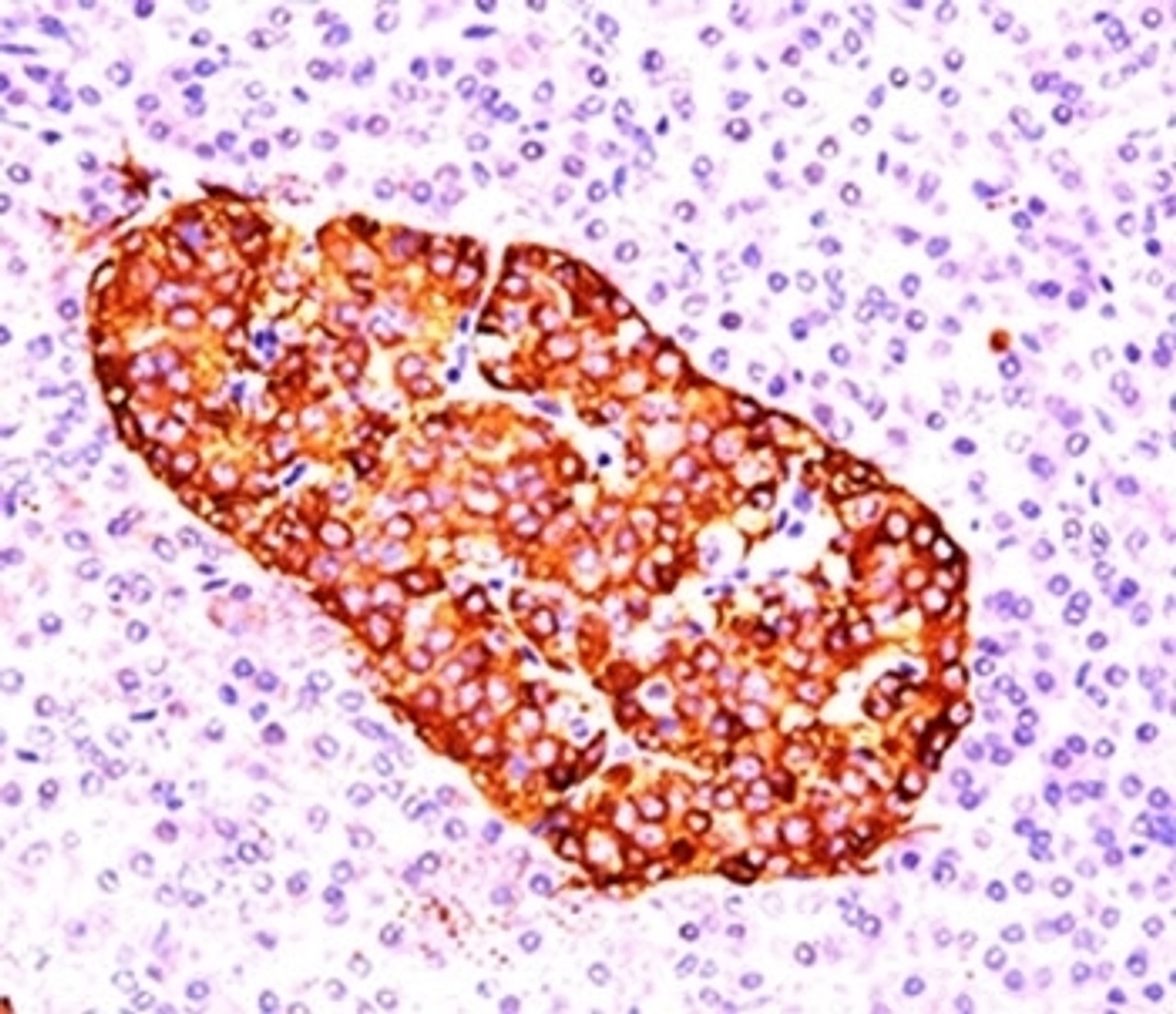 IHC testing of pancreas stained with chromogranin A antibody (CGA414) .