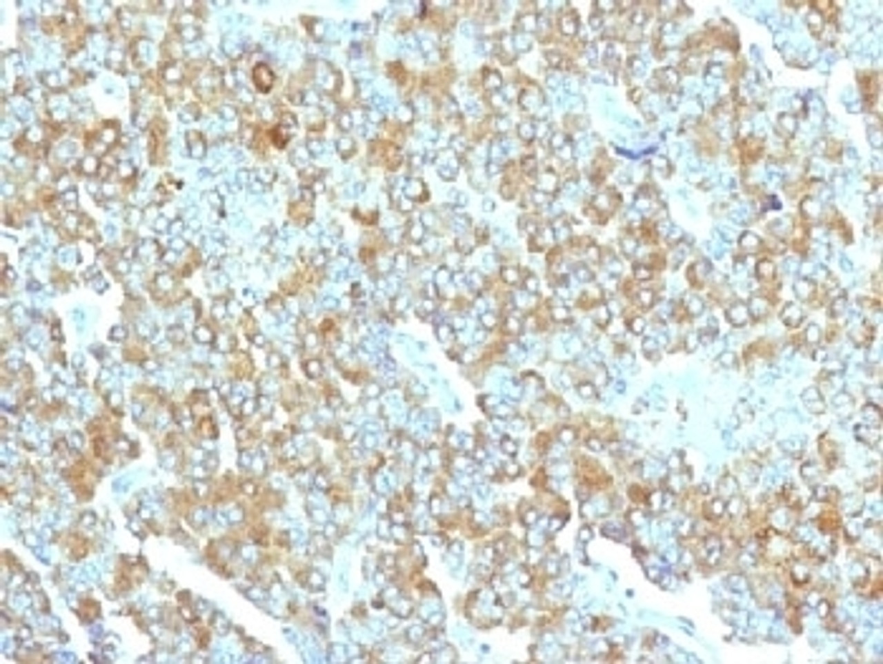 IHC testing of FFPE human adrenal gland with Chromogranin A antibody