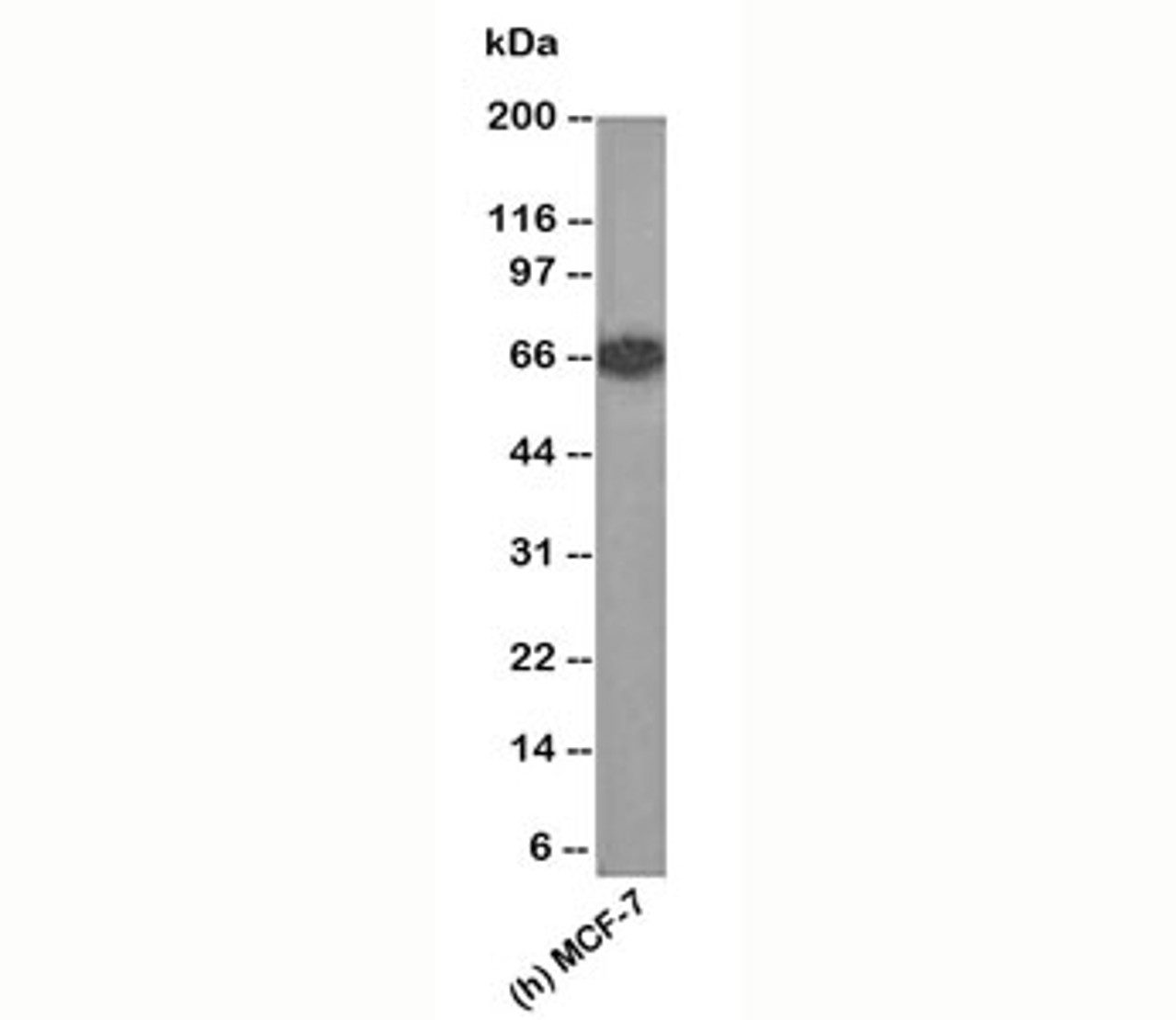 Western blot testing of human samples using Estrogen receptor antibody (ER505) .