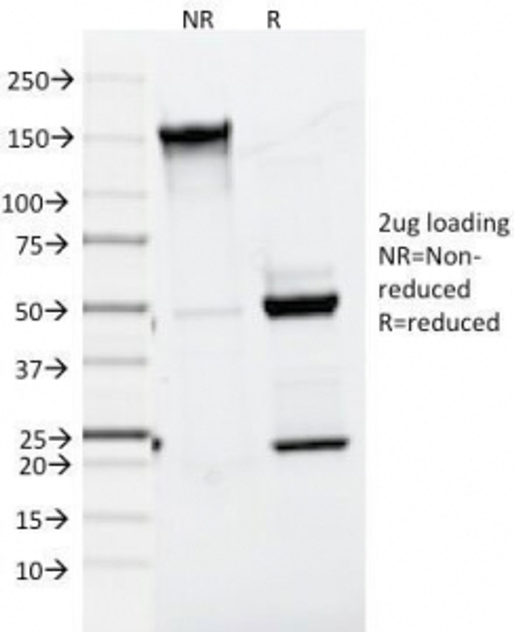 SDS-PAGE Analysis of Purified, BSA-Free Melan-A Antibody (clone A103) . Confirmation of Integrity and Purity of the Antibody.