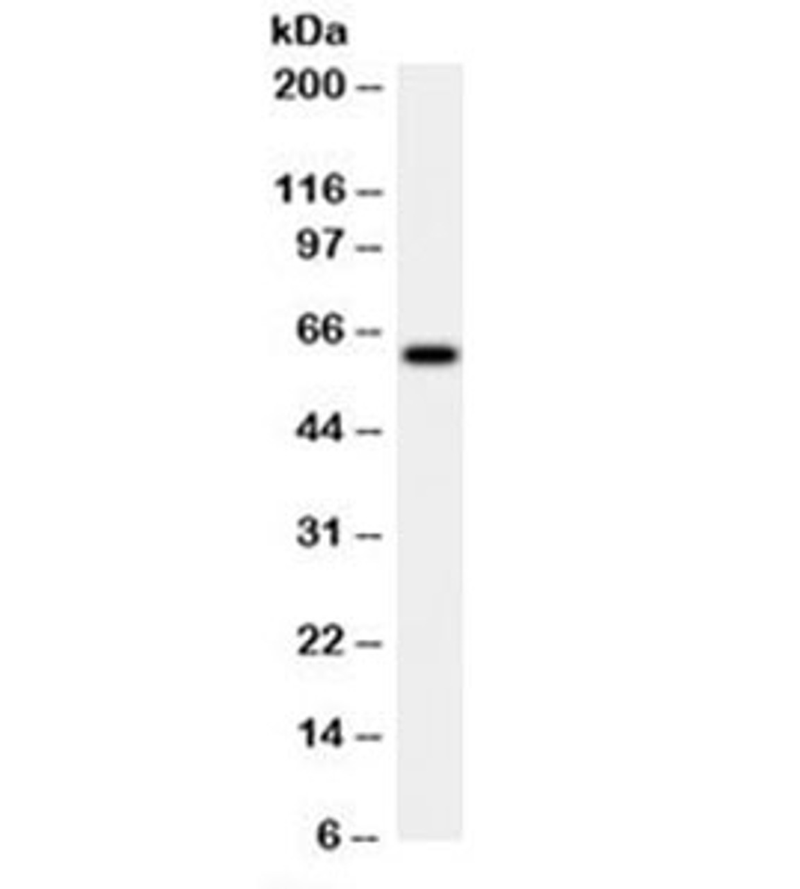 Western blot testing of HeLa cell lysate with HSP60 antibody (clone LK2) .