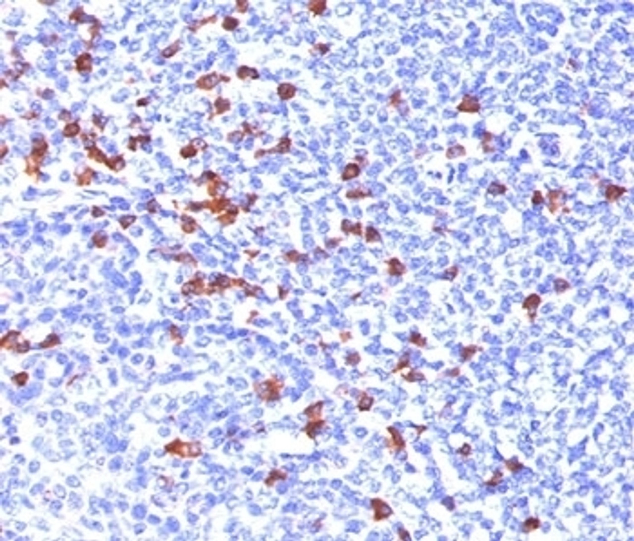 IHC testing of human tonsil stained with anti-IgG antibody (IG266) .