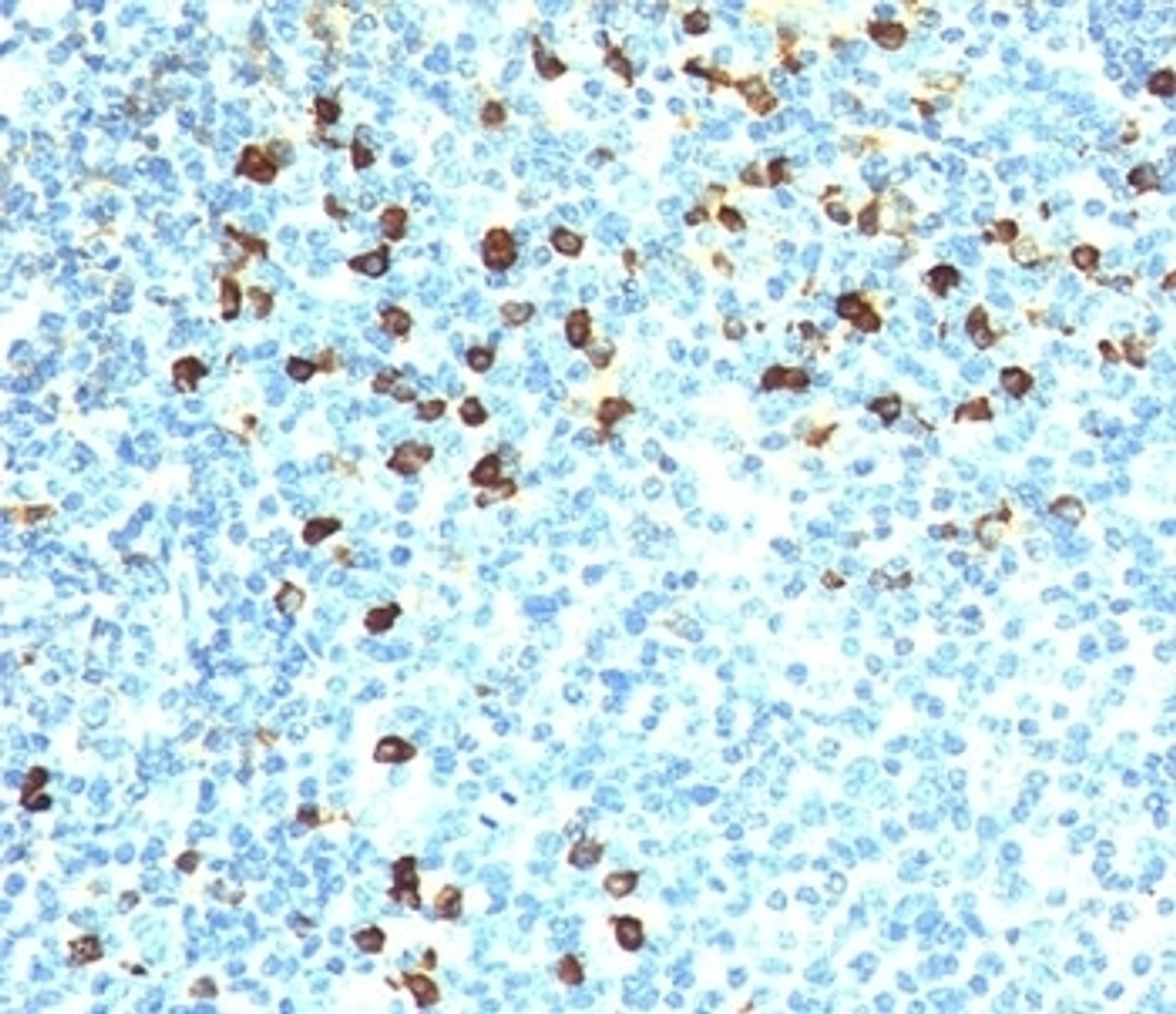 IHC testing of human tonsil stained with Kappa antibody (KLC264) . Note cell membrane & cytoplasmic staining.