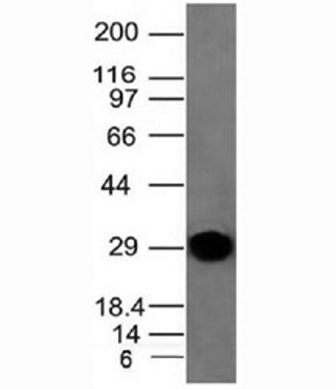 Western blot analysis of human spleen tissue and Kappa antibody.