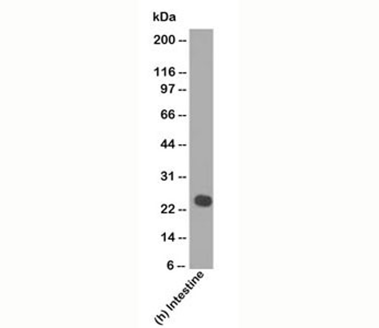 Western blot testing of human samples using lambda light chain antibody (LcN-2) .