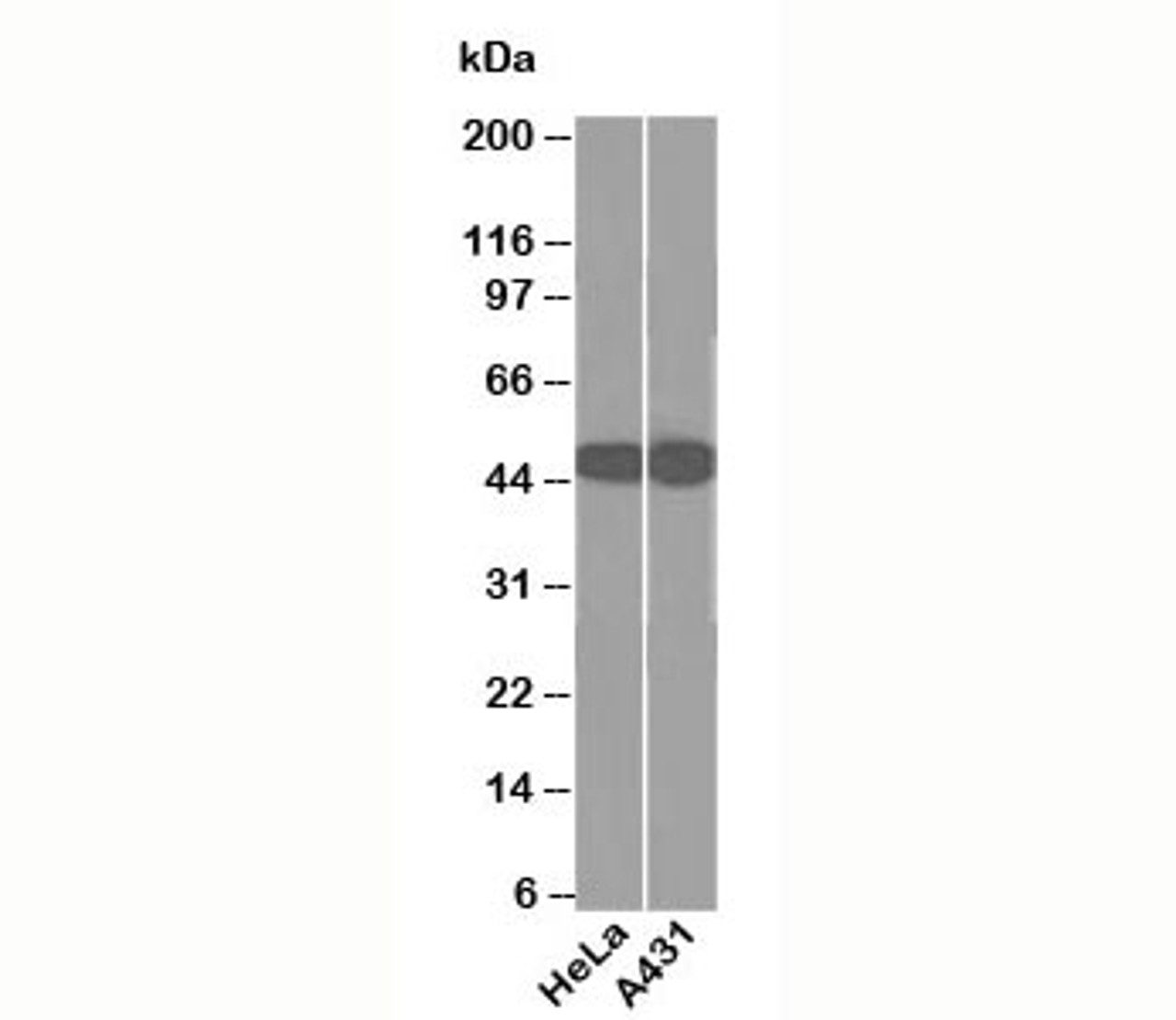 Western blot testing of human samples using DC10 antibody.