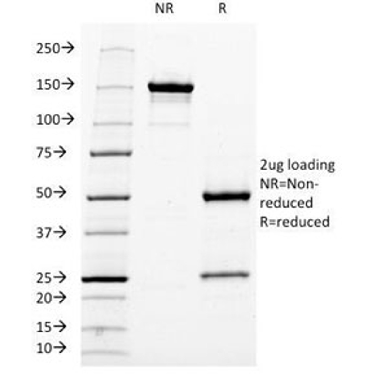 SDS-PAGE Analysis of Purified, BSA-Free Neurofilament Antibody (clone NF421) . Confirmation of Integrity and Purity of the Antibody.