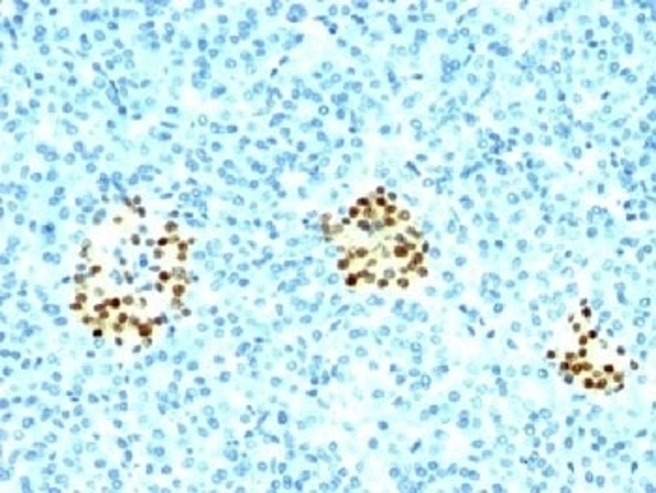 IHC testing of human pancreas stained with NKX2.2 antibody (NX2/294) .