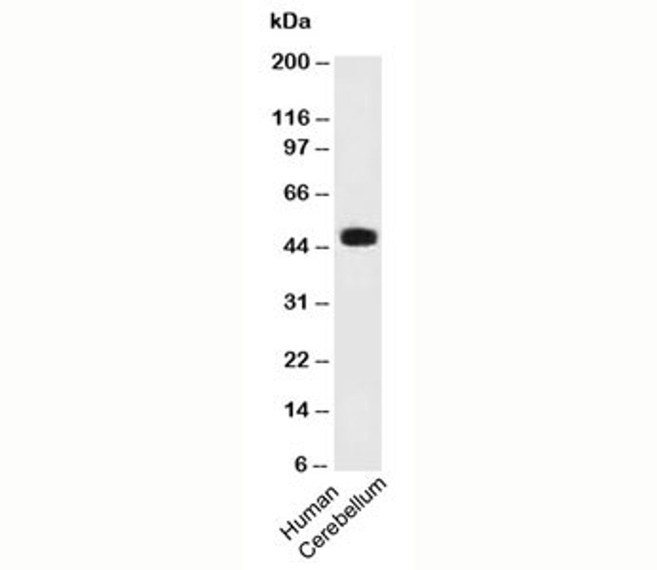 Western blot testing of human samples using PAX6 antibody (PAX6/498) .