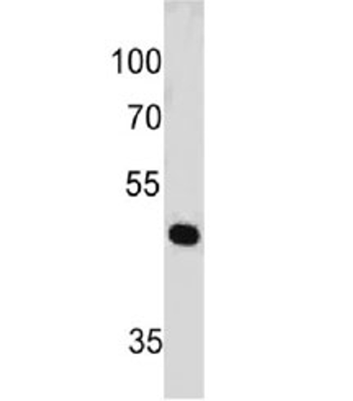 Western blot testing of human HeLa cell lysate with PAX7 antibody (clone PAX7/497) . Expected molecular weight: 55-57 kDa.