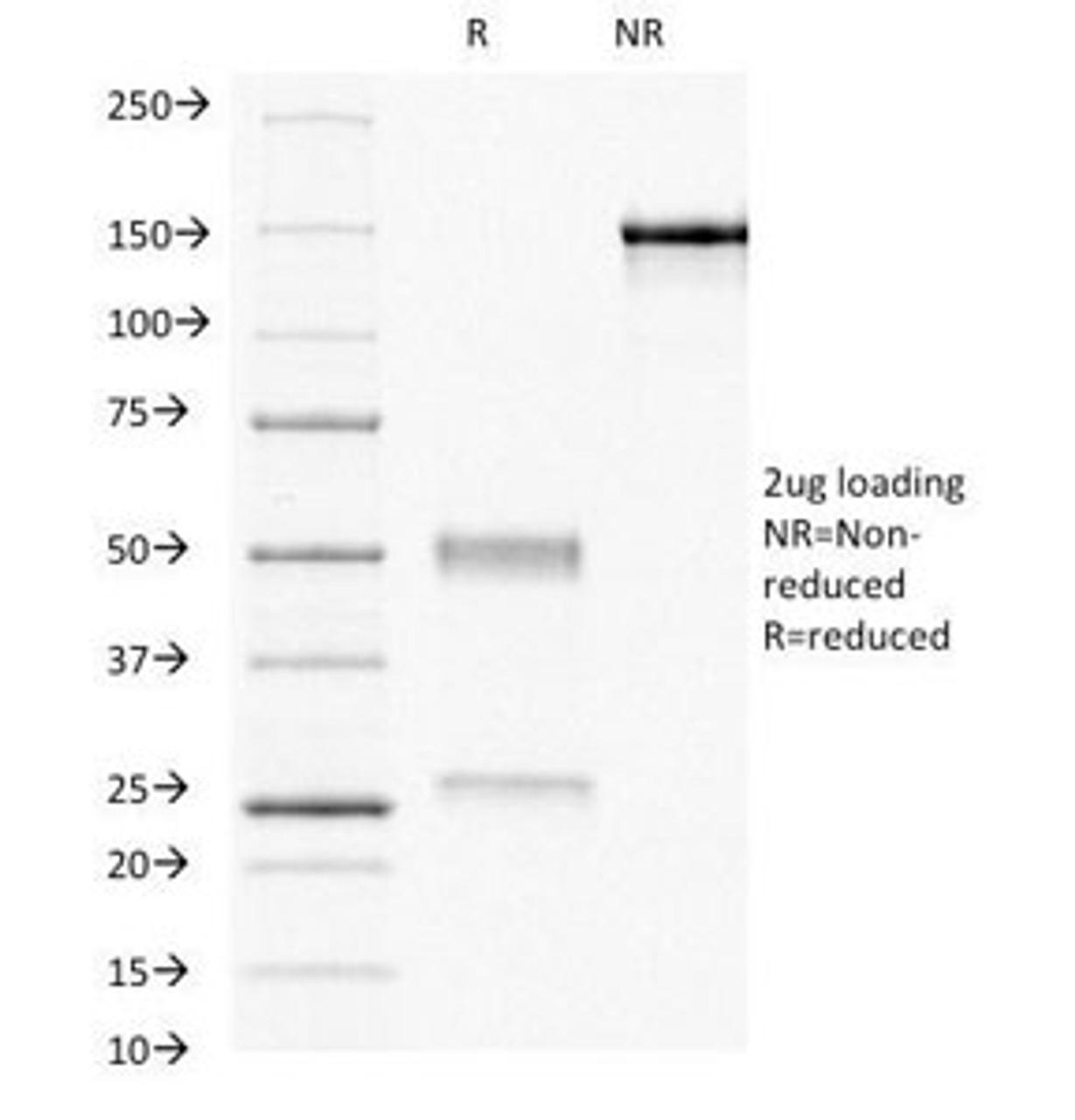 SDS-PAGE Analysis of Purified, BSA-Free Progesterone Receptor Antibody (clone PR484) . Confirmation of Integrity and Purity of the Antibody.