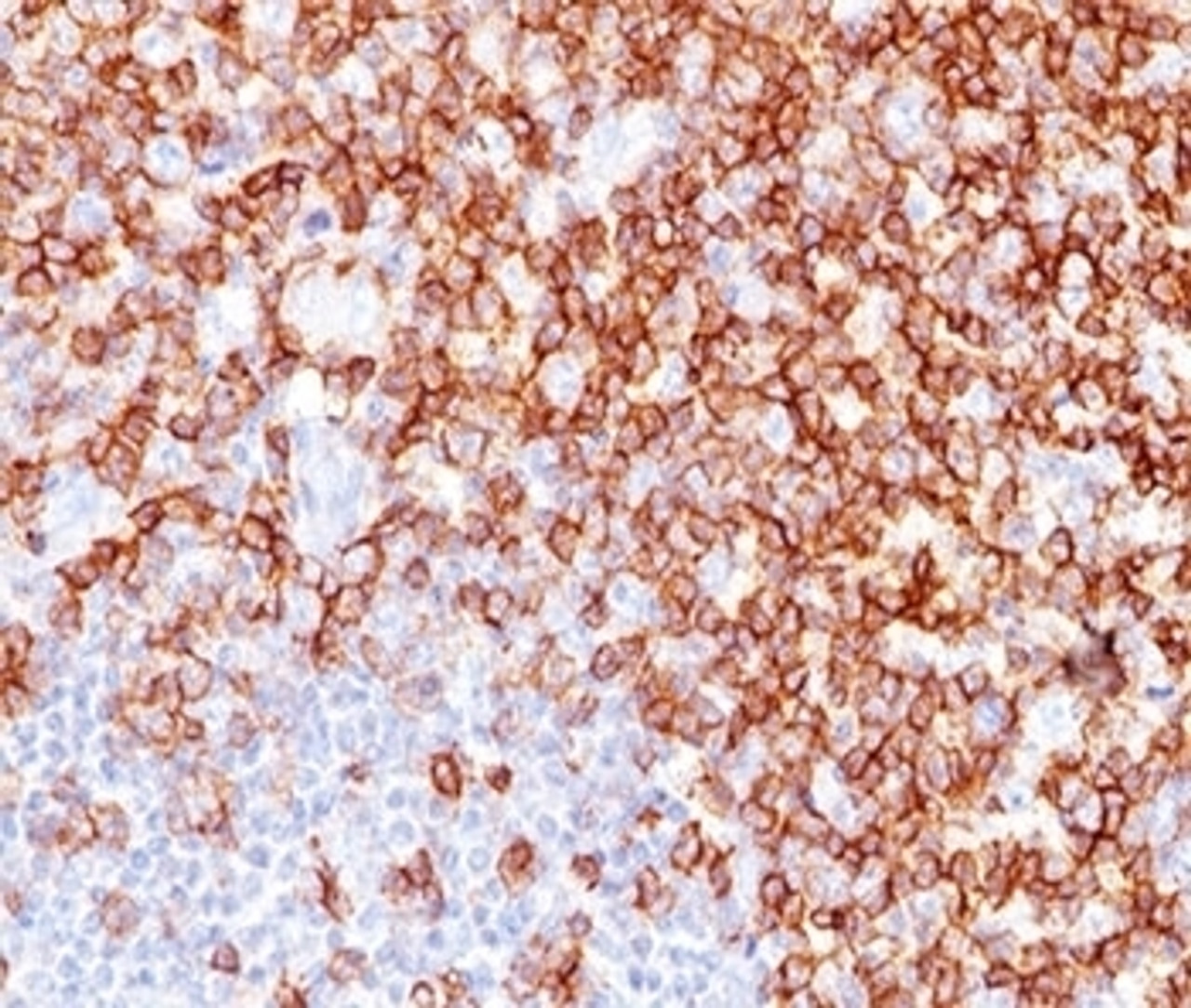 IHC testing of human tonsil stained with CD45RO antibody (UCHL-1) .