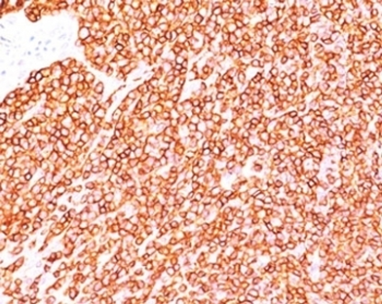 IHC testing of human tonsil stained with CD45RB antibody (BRA-11) .