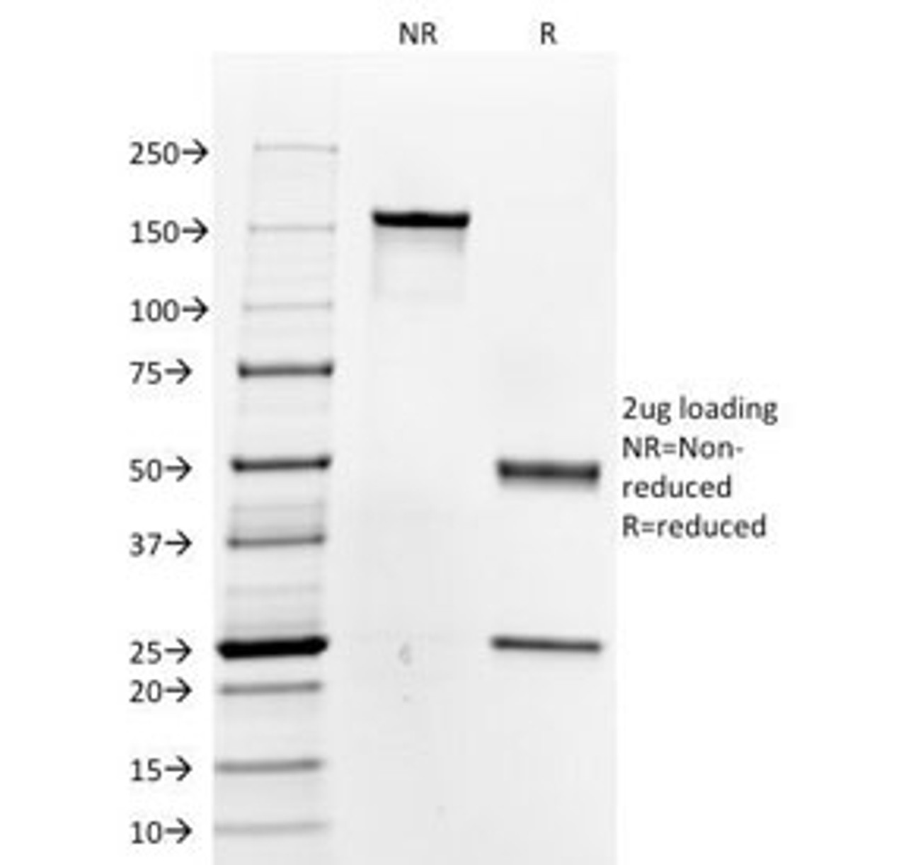 SDS-PAGE Analysis of Purified, BSA-Free Thyroglobulin Antibody (clone 6E1 or TGB05) . Confirmation of Integrity and Purity of the Antibody.