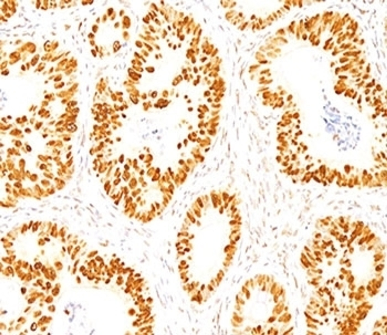 IHC staining of normal colon with p53 antibody (DO-7) .