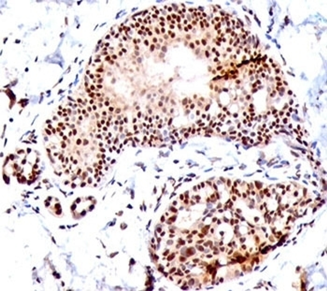 IHC staining of human tonsil with SUMO1 antibody (SM1/495) .