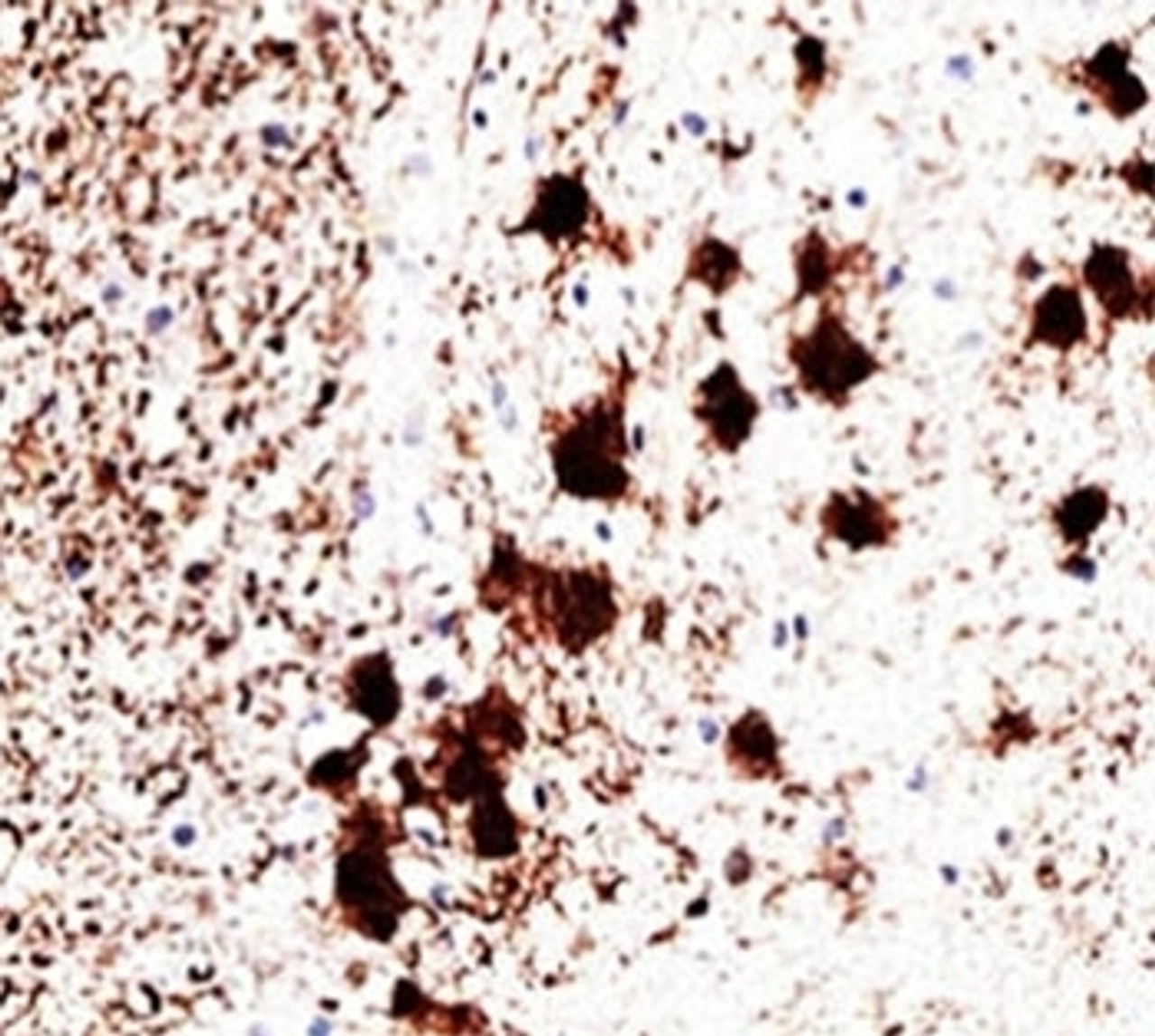 IHC staining of human brain with PGP9.5 antibody (31A3) .