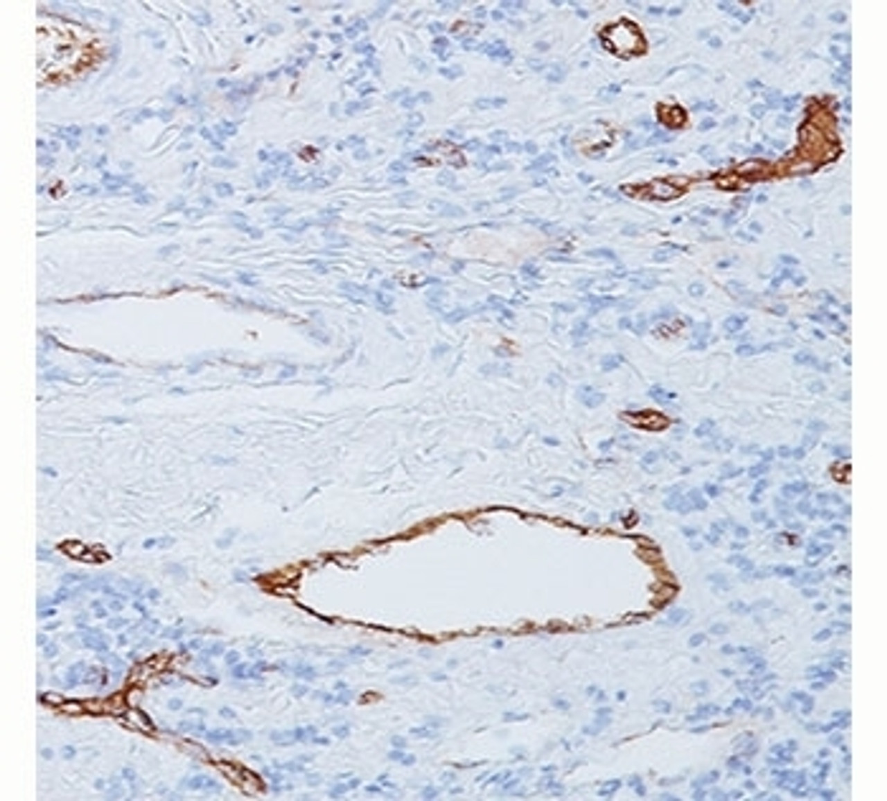 IHC staining of human tonsil with vWF antibody (3E2D10) .