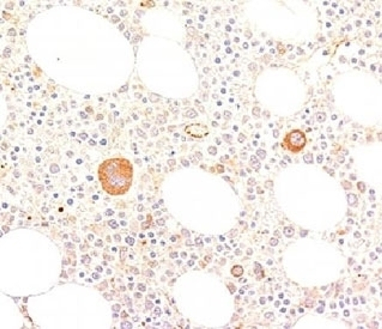 IHC staining of human bone marrow with von Willebrand Factor antibody (VWF635) .