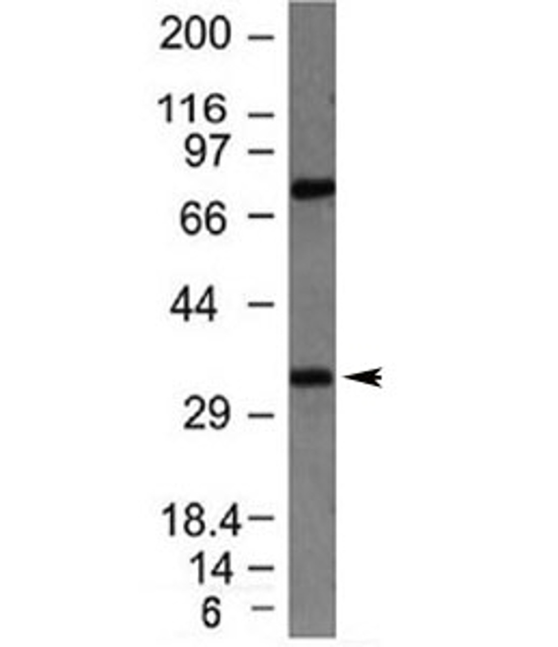 Western blot testing of HepG2 lysate with Bcl10 antibody