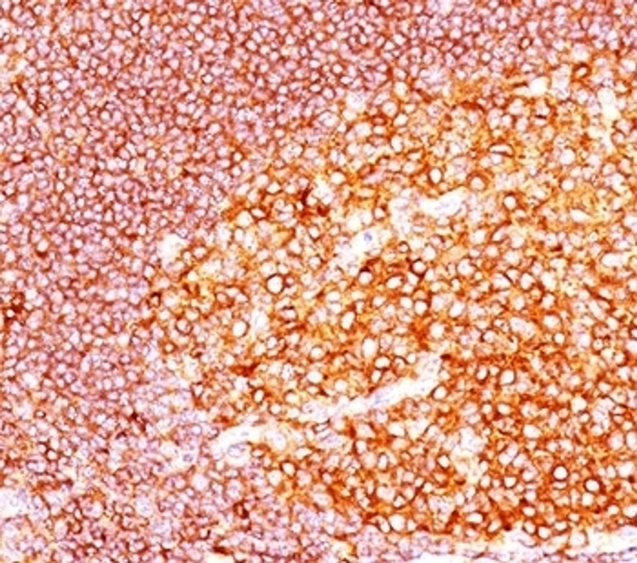 IHC staining of tonsil tissue with MALT1 antibody (MT1/410) .