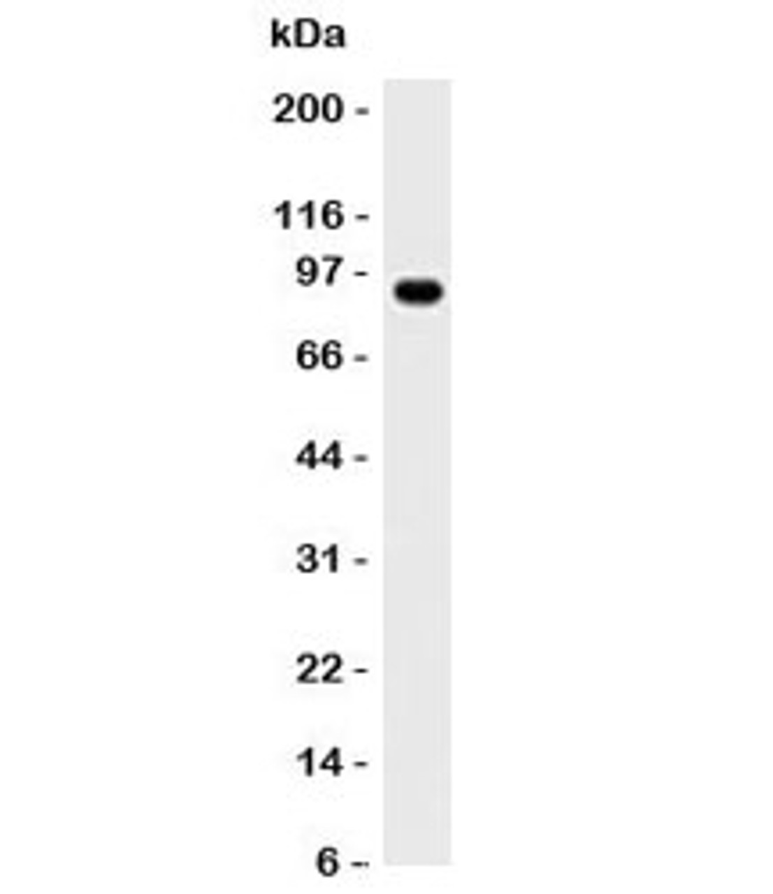 Western blot analysis of Daudi lysate and MALT1 antibody. Expected molecular weight ~92 kDa.