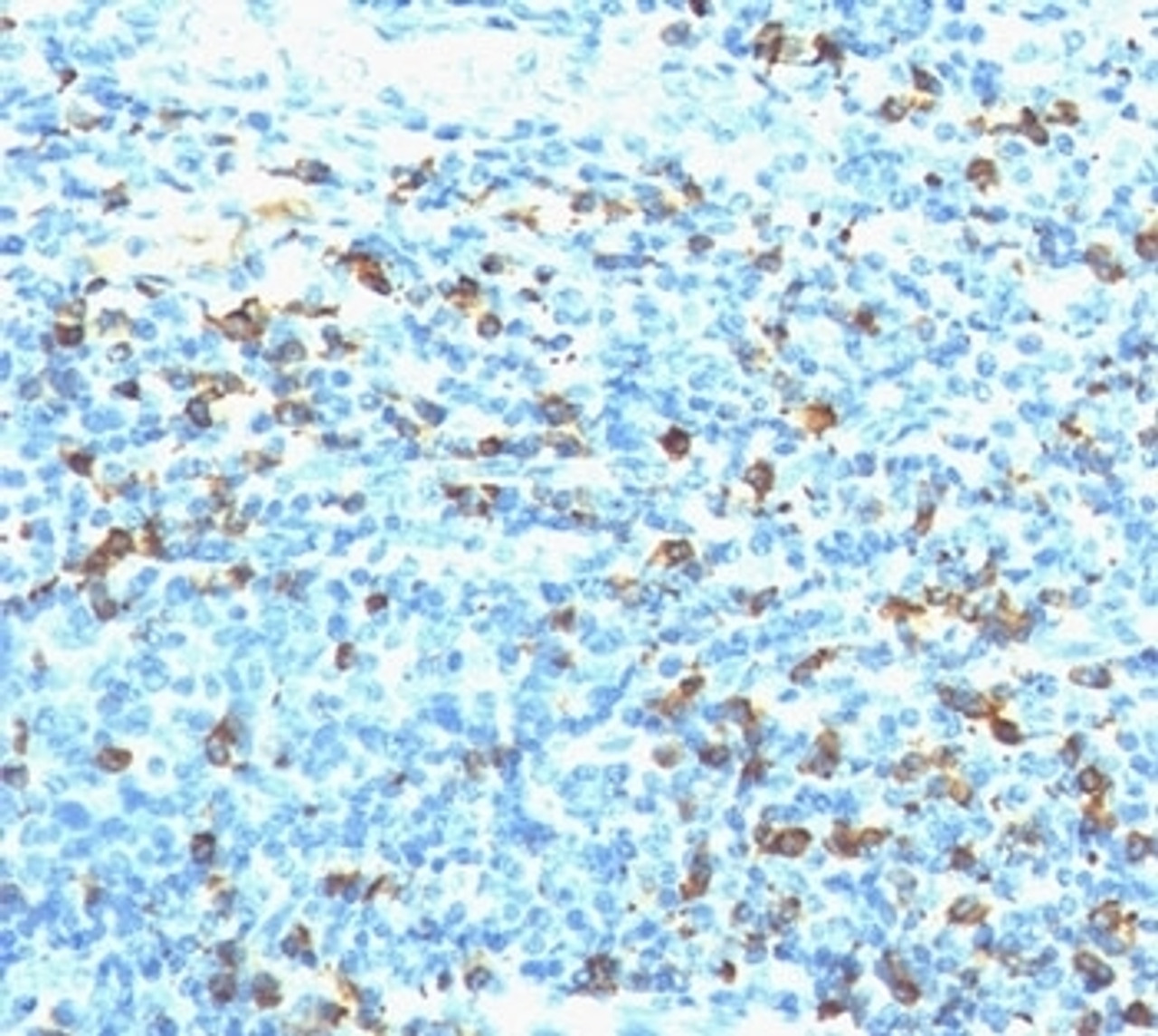 IHC staining of human tonsil with biotinylated lambda light chain antibody followed by anti-Biotin antibody (Hyb-8) . Note cell membrane & cytoplasmic staining.