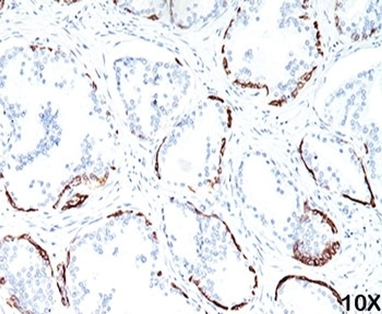 IHC staining of human prostate (10X) with HMW Cytokeratin antibody (34bE12) .