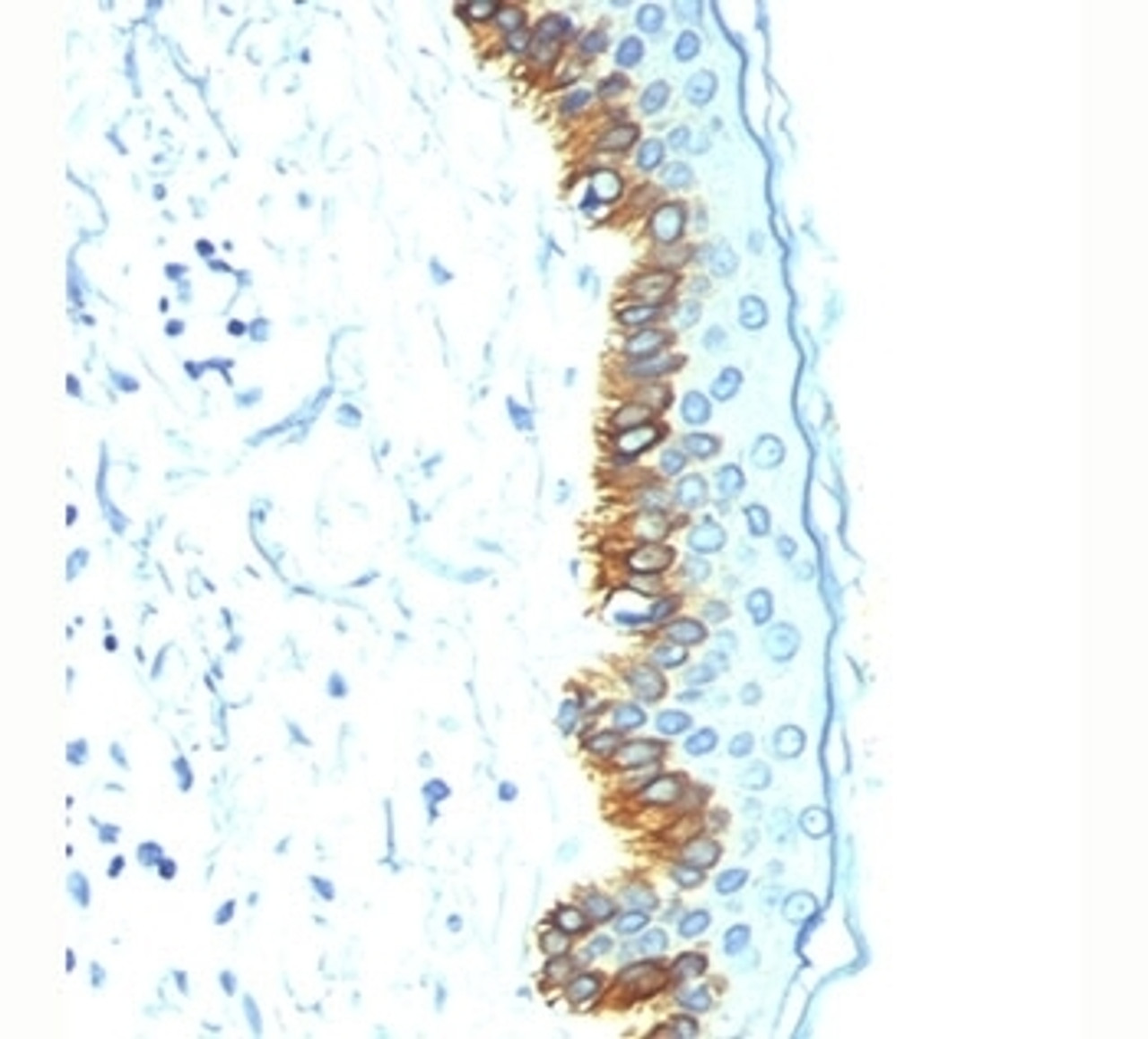 IHC staining of human skin with Acidic Cytokeratin antibody AE1.