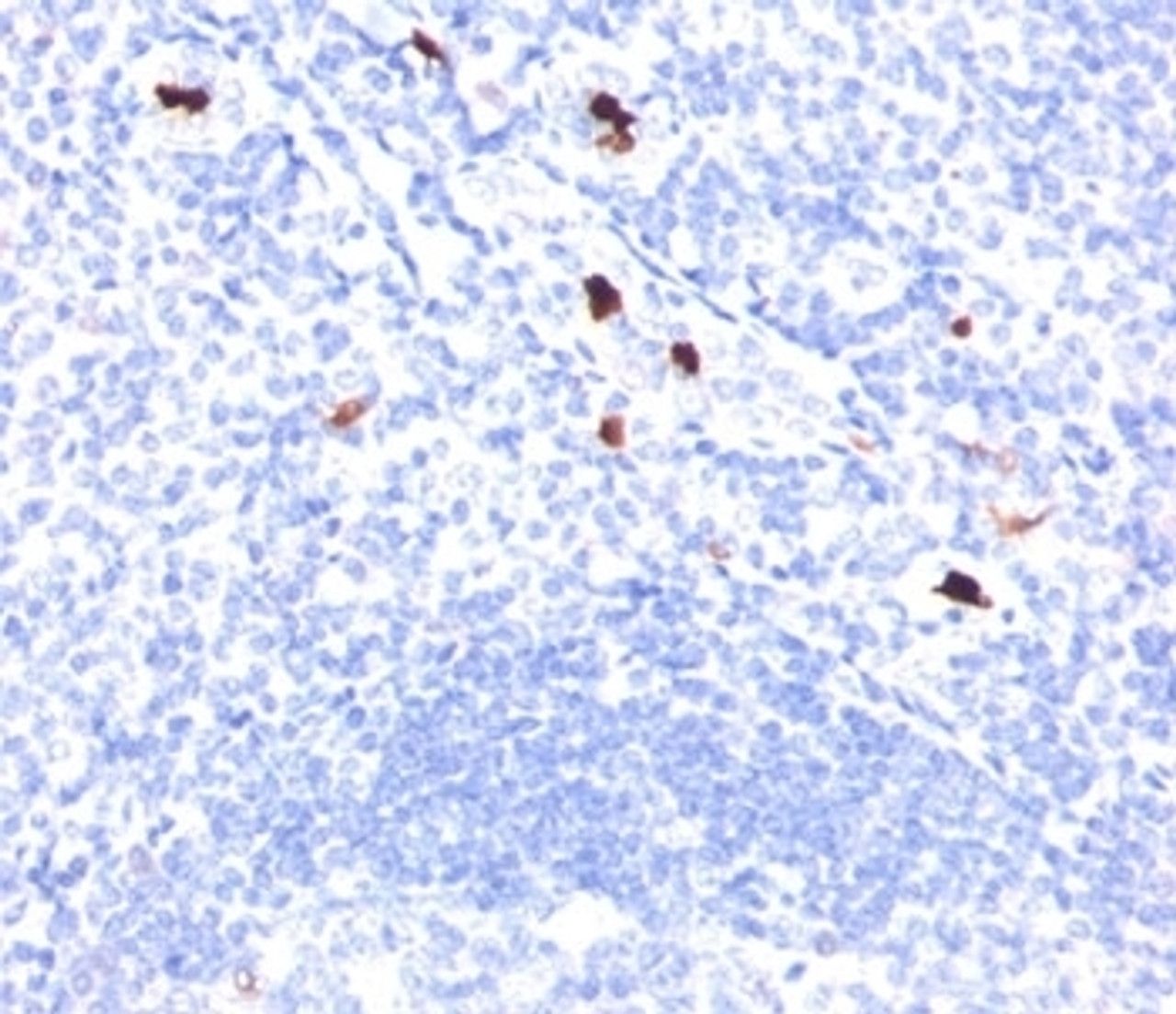 Formalin/paraffin human tonsil stained with Myeloid cell marker antibody (BM-1) .