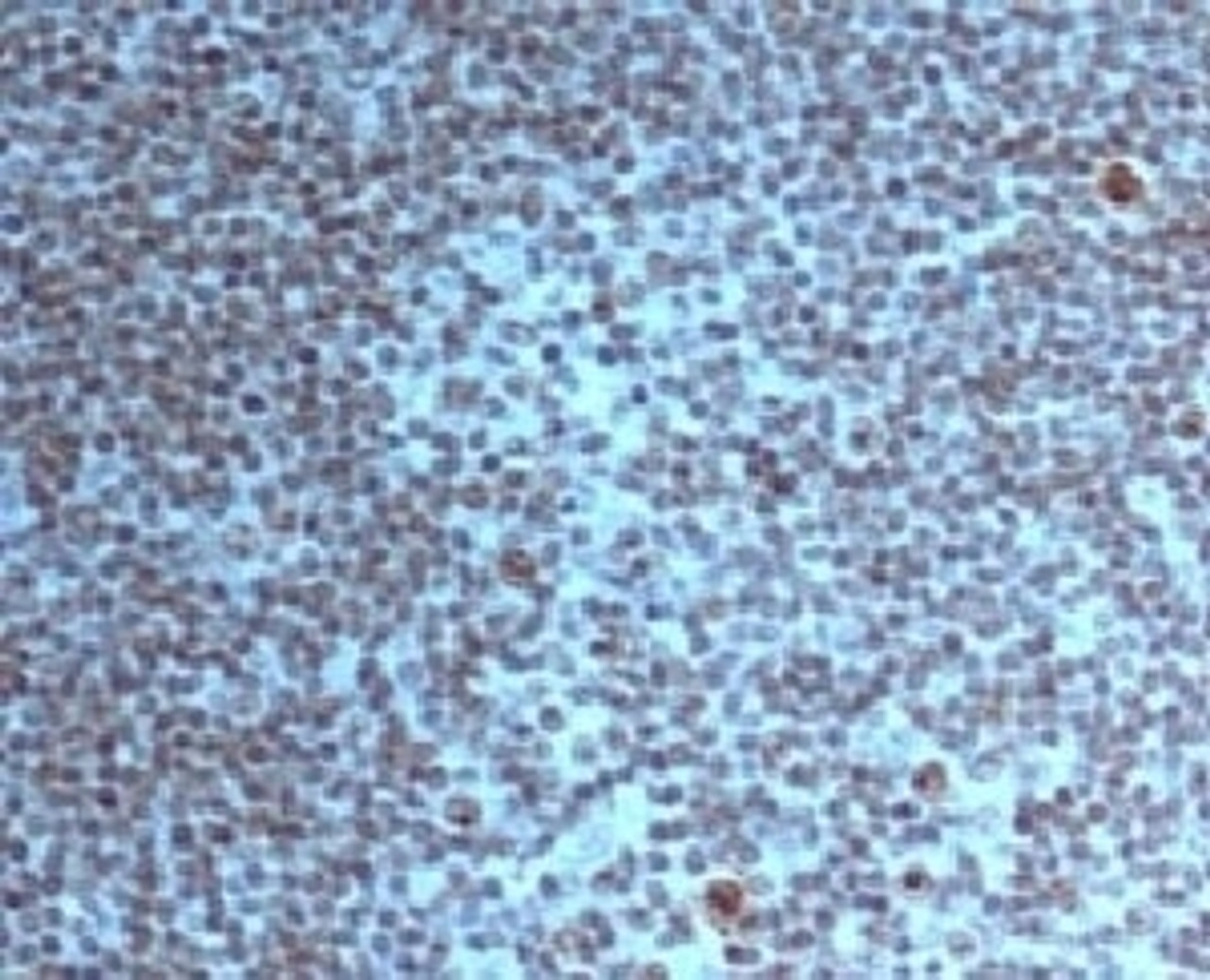 IHC staining of FFPE human tonsil tissue with Nucleoli marker antibody.