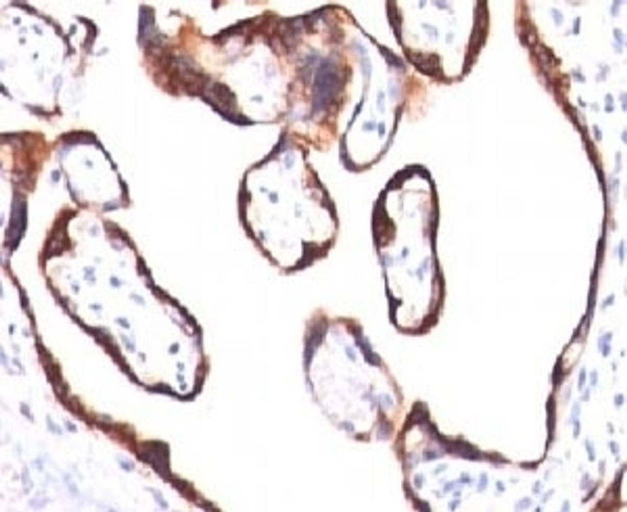 Immunohistochemical testing of human placenta with HCG-beta antibody (HCGb/459) .