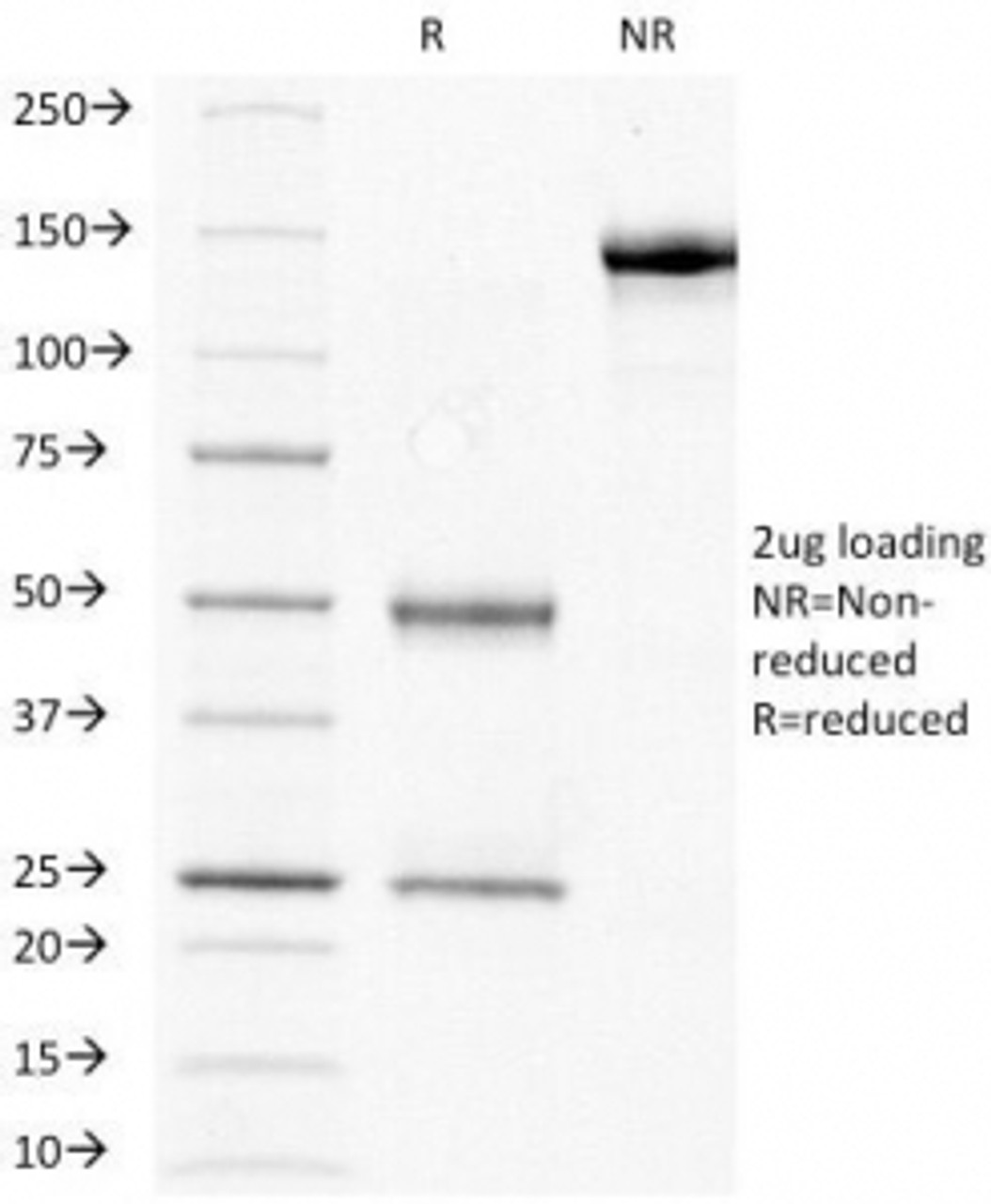 SDS-PAGE Analysis of Purified, BSA-Free HCG-beta Antibody (clone HCGb/211) . Confirmation of Integrity and Purity of the Antibody.