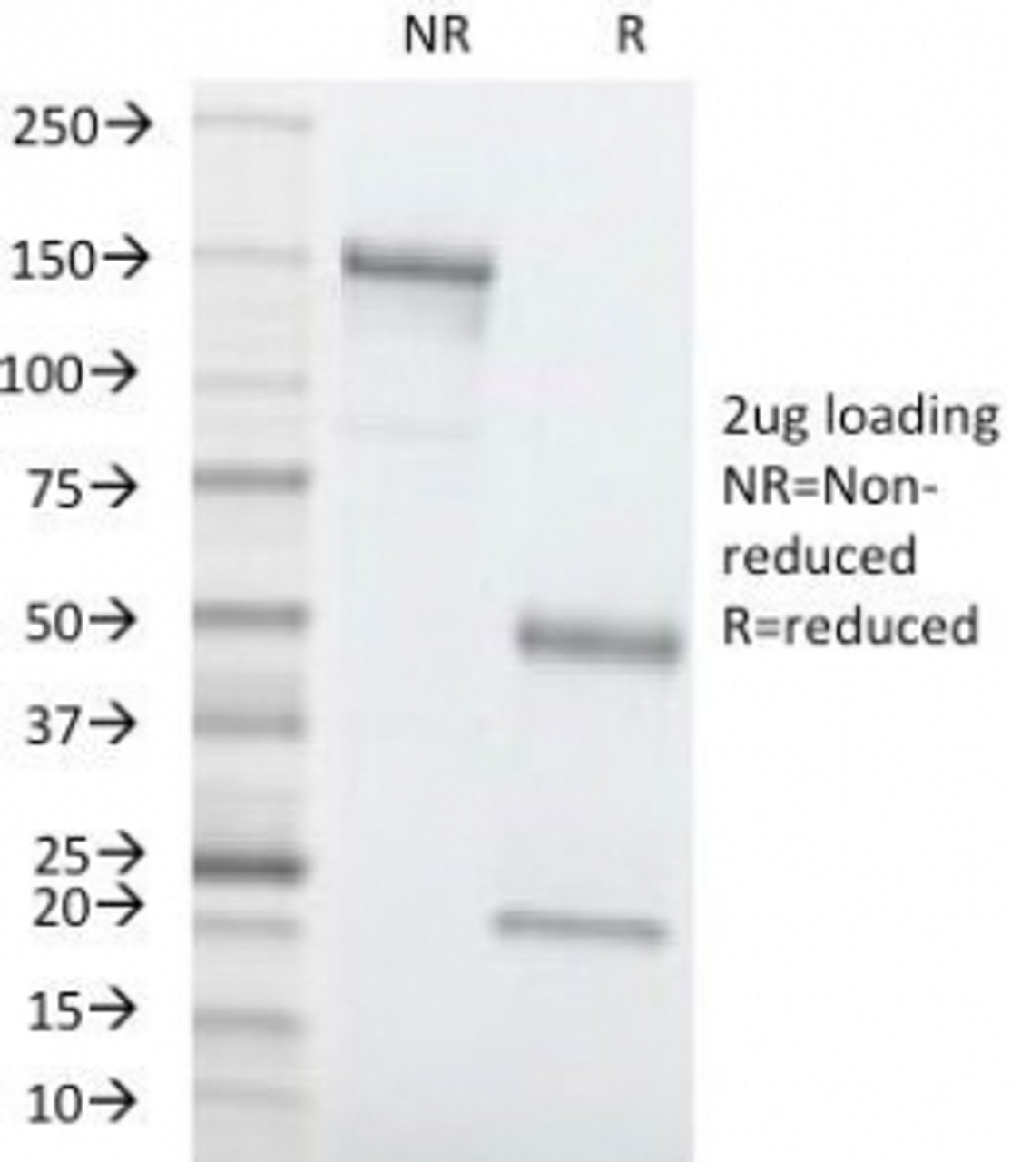 SDS-PAGE Analysis of Purified, BSA-Free CEA Antibody (clone C66/1260) . Confirmation of Integrity and Purity of the Antibody.