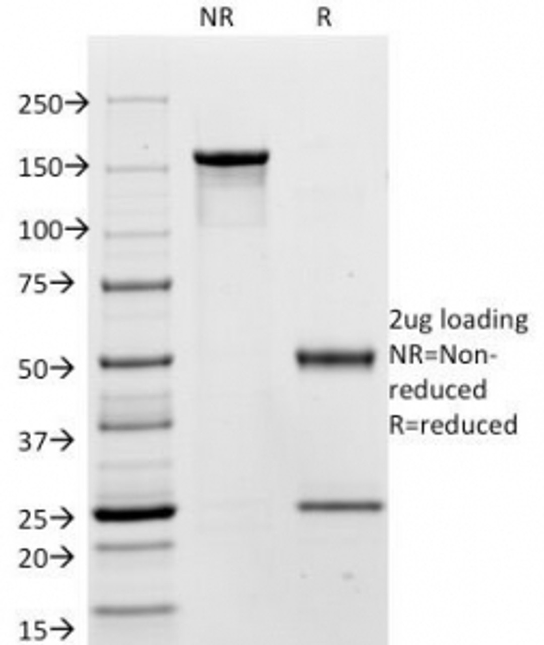 SDS-PAGE Analysis of Purified, BSA-Free CEA Antibody (clone C66/195) . Confirmation of Integrity and Purity of the Antibody.