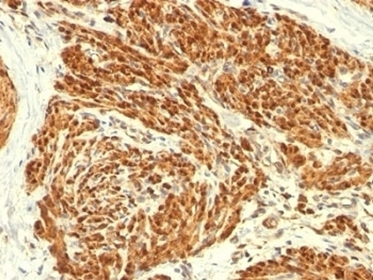 Formalin-fixed, paraffin-embedded human uterus stained with Calponin antibody (CALP) .