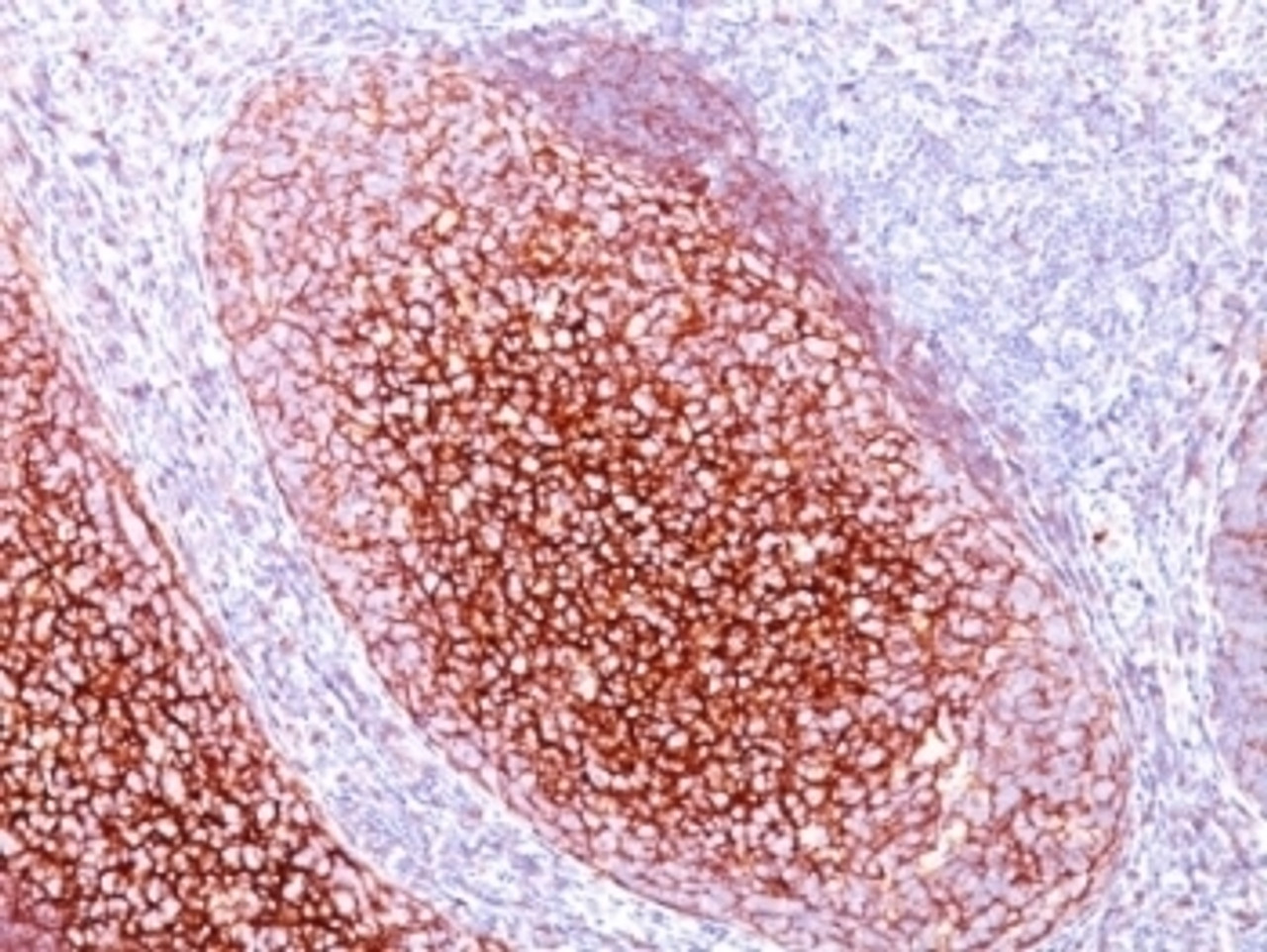 Formalin-fixed, paraffin-embedded human tonsil stained with CD35 antibody (CR1/802) .