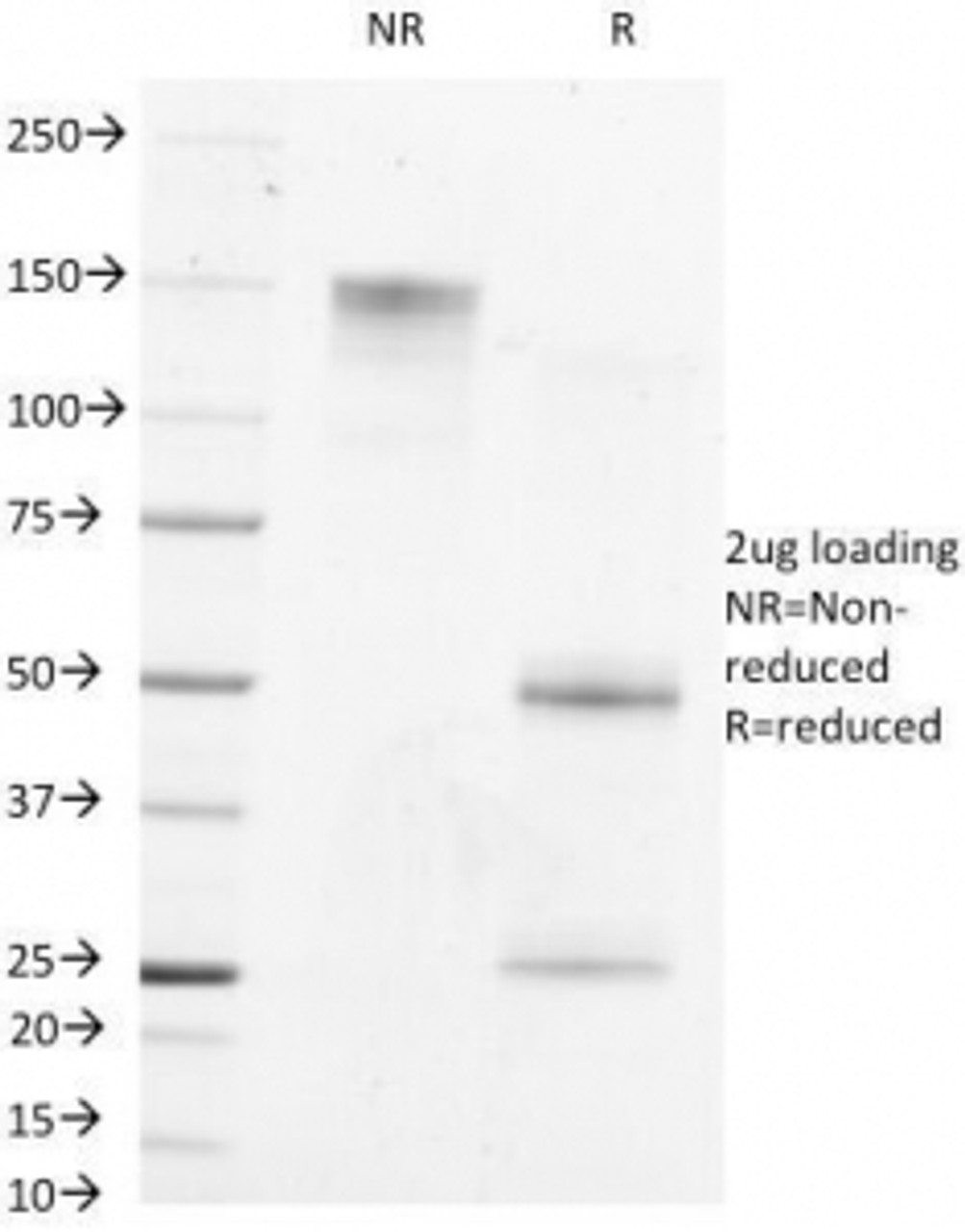 SDS-PAGE Analysis of Purified, BSA-Free AFP Antibody (clone MBS-12) . Confirmation of Integrity and Purity of the Antibody.