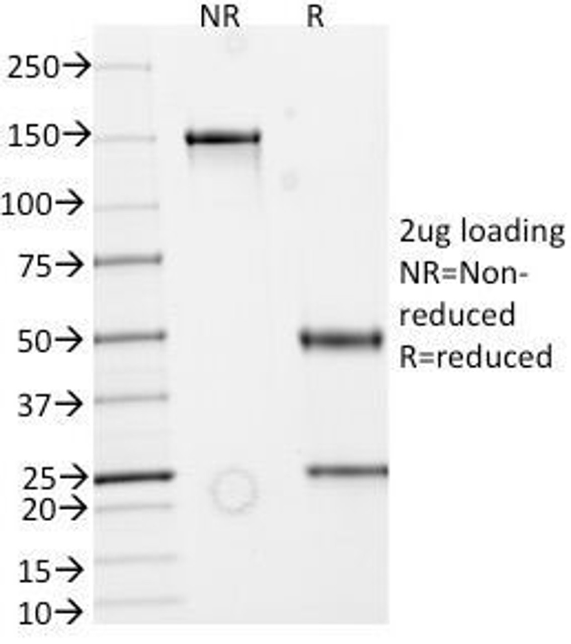 SDS-PAGE Analysis of Purified, BSA-Free Secretory Component Glycoprotein Antibody (clone ECM1/792) . Confirmation of Integrity and Purity of the Antibody.