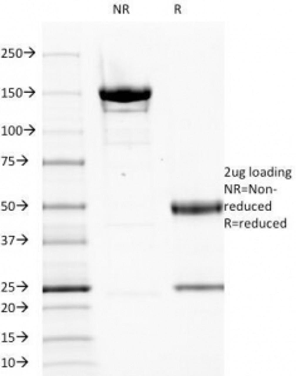 SDS-PAGE Analysis of Purified, BSA-Free EGFR Antibody (clone GFR1195) . Confirmation of Integrity and Purity of the Antibody.