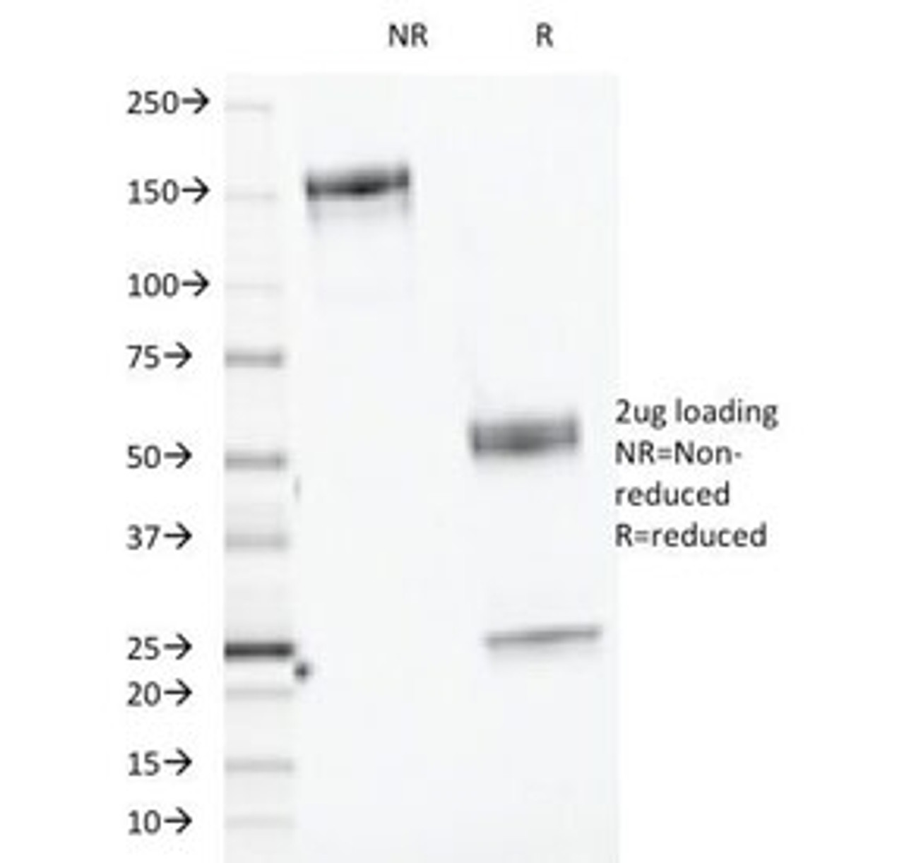 SDS-PAGE Analysis of Purified, BSA-Free CELA3B Antibody (clone CELA3B/1218) . Confirmation of Integrity and Purity of the Antibody.